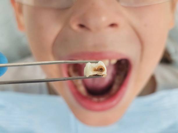 Best Emergency Treatment for Toothache in Loyal, WI